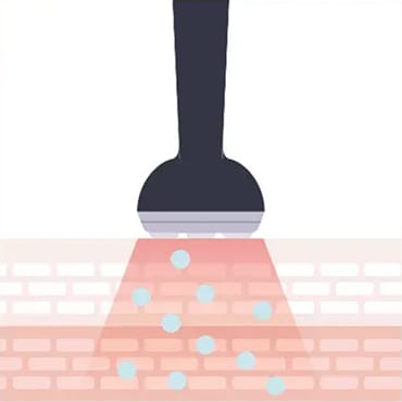 エレクトロポレーション